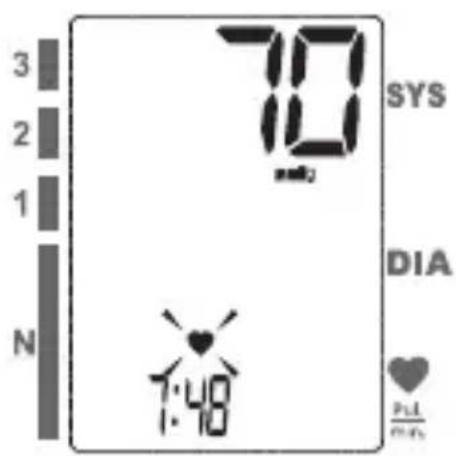 Medel Soft TMB-1581-S - Model: TMB-1581-S - 16