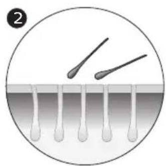 PHILIPS Lumea 9900 Series BRI951 - So funktioniert IPL - 2