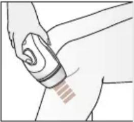 BRAUN Silk-expert Pro 5 PL5242 - Méthodes de traitement - 2