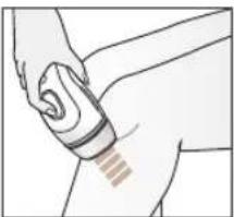 BRAUN Silk-expert Pro 5 PL5262 - Metodi di trattamento - 2