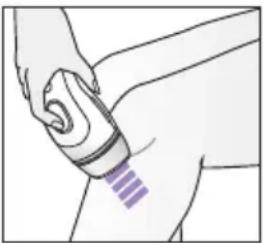 BRAUN Silk-expert Pro 3 PL3233 - Metodi di trattamento - 2