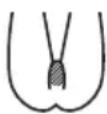 BRAUN Skin-i.expert Pro PL7253 - So behandeln Sie den Intimbereich (nur für Frauen) - 2