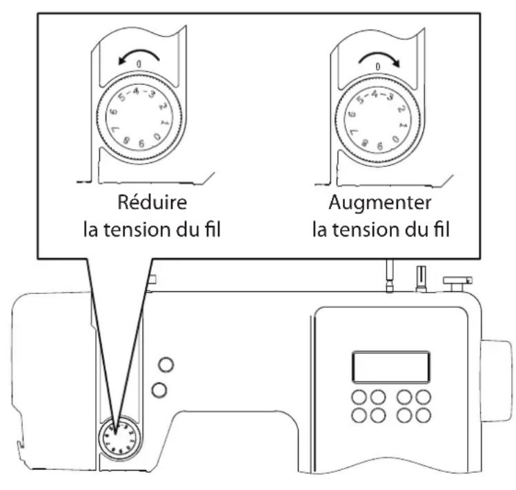 MEDION LIFE SD36 - Réglage de la tension du fi I supérieur - 1