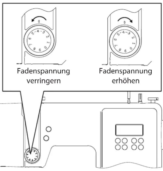MEDION LIFE SD36 - Regulierung der Oberfadenspannung - 1
