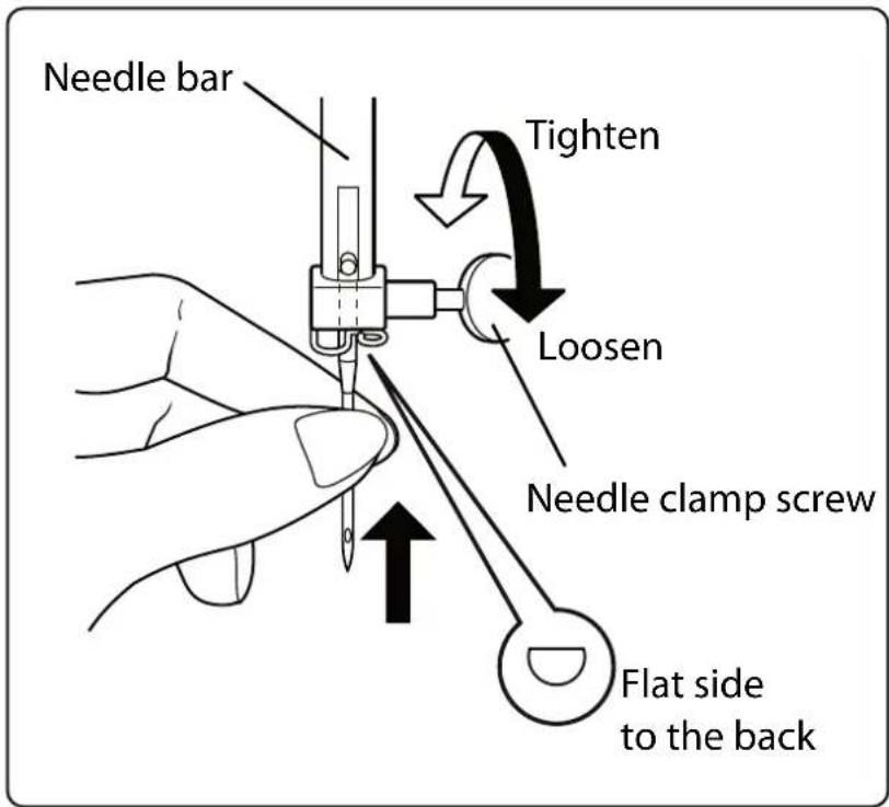 MEDION LIFE SD36 - Replacing the needle - 1