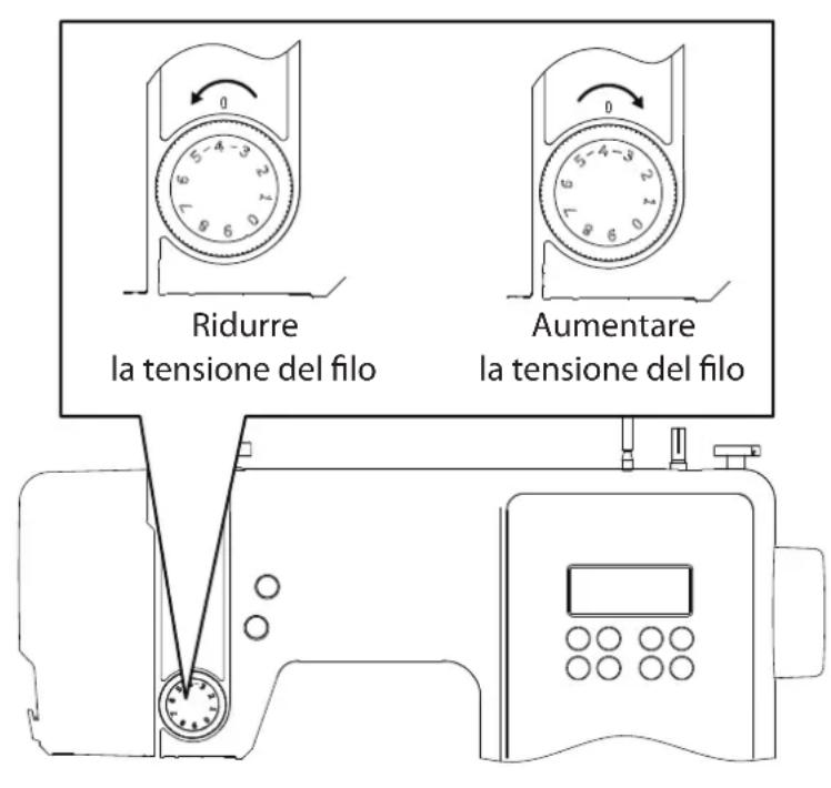 MEDION LIFE SD36 - Regolazione della tensione del fi lo superiore - 1