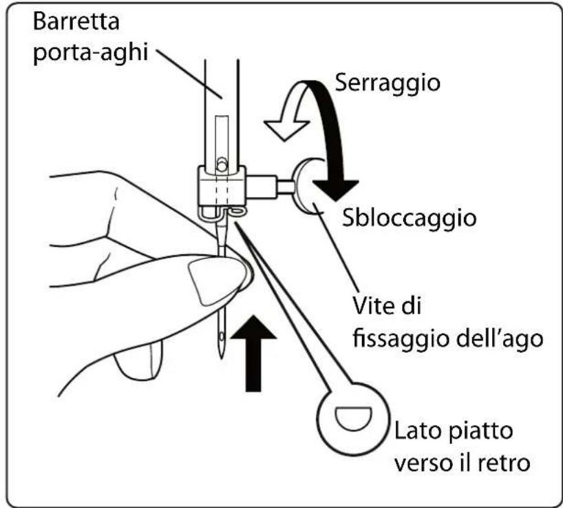 MEDION LIFE SD36 - Sostituzione dell'ago - 1