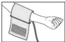 Medel Sense - Applicazione del manicotto - 1