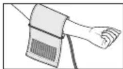 Medel Elite - Applicazione del bracciale - 1