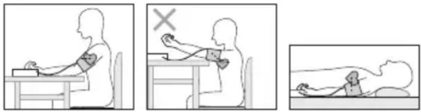 Medel Control - Applicazione del manicotto - 2