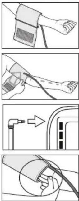 Medel Control - Colocación del brazalete - 1