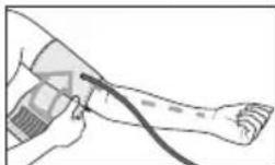 Medel Control - Attaching the cuff - 2