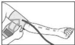 Medel Control - Manschette anlegen - 2