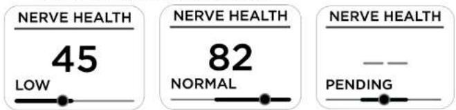 WITHINGS Body Comp WBS12 - Måling af en nervesundhedsscore (Nerve Health Score) - 2