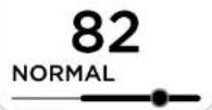 WITHINGS Body Comp WBS12 - NERVE HEALTH - 1