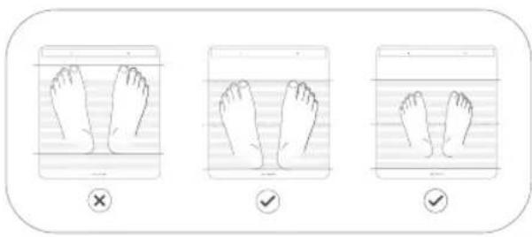 WITHINGS Body Scan - Az idegegészségi pontszám mérése - 1