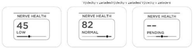 WITHINGS Body Scan WBS08 - Príznaky neuropatie - 1