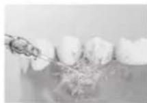 PANASONIC EW-DJ66 - Îngrijirea gingiilor - 3