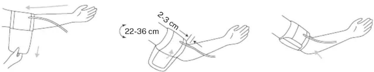 Create BIPCARE - Cuff Placement - 1