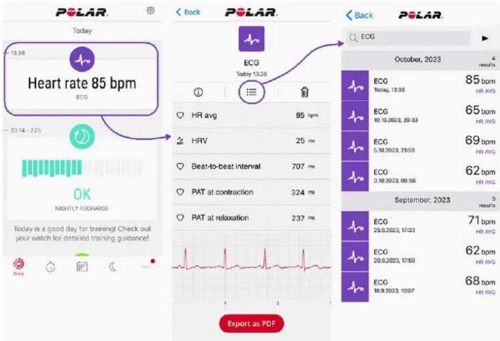 POLAR Vantage M3 - Résultats du test ECG dans l'application Polar Flow - 2