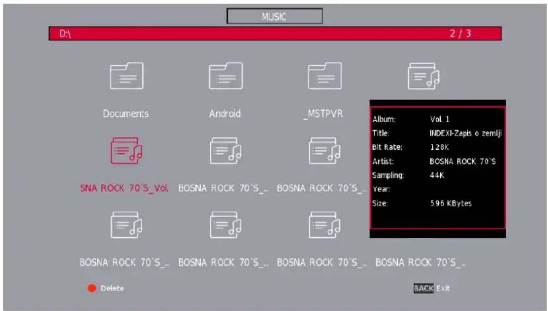 THOMSON 40HD2S14 - Menu Musique - 2