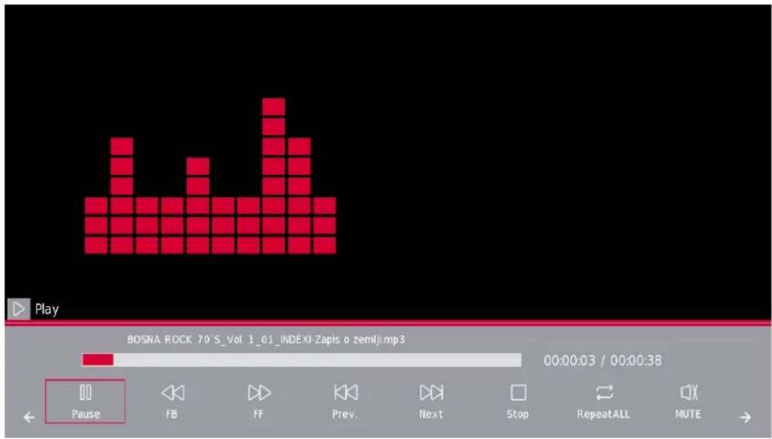 THOMSON 40HD2S14 - Menu Musique - 3