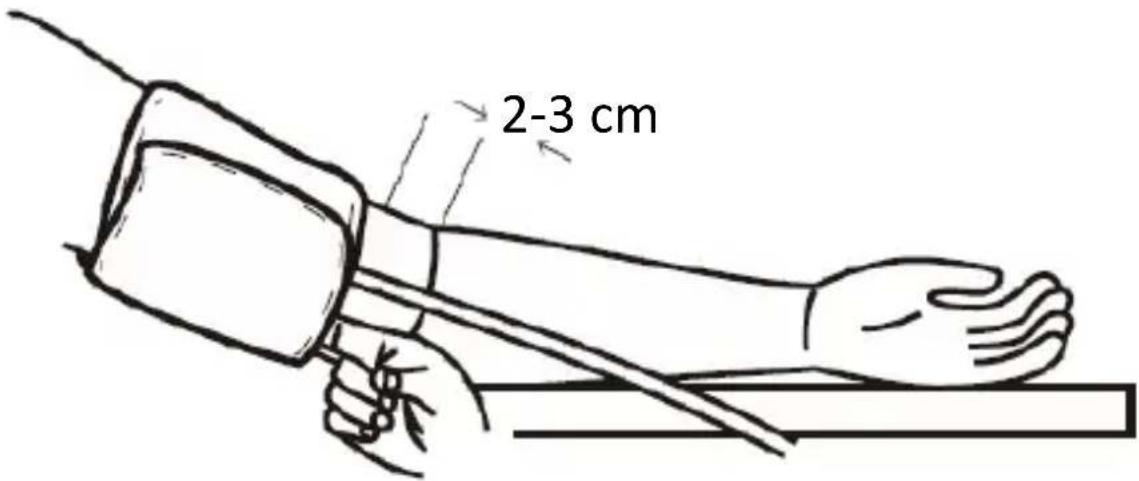 Newgen Medicals OB-300 - Manschette anlegen - 2