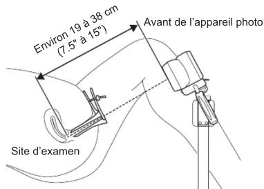 Environ 19 à 38 cm (7.5° à 15") Avant de l'appareil photo Site d'examen