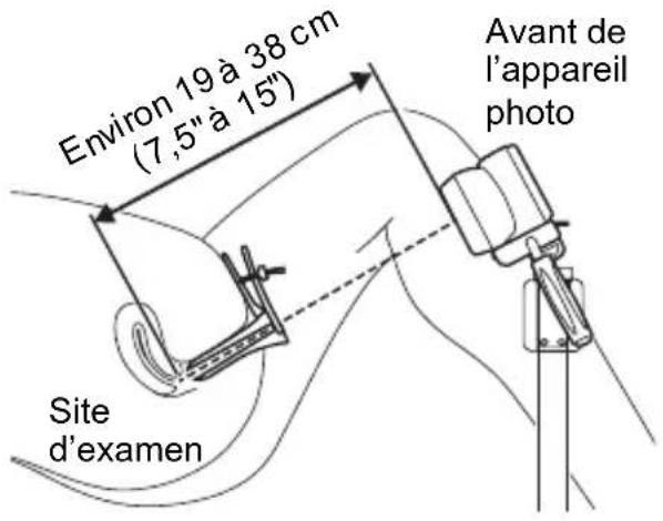 Avant de l'appareil photo Environ 19 à 38 cm (7,5" à 15") Site d'examen