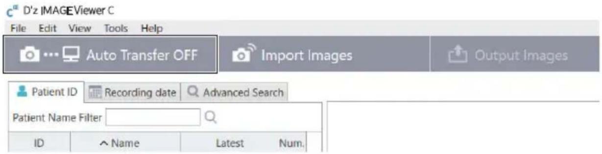 D'z IMAGEViewer C File Edit View Tools Help Auto Transfer OFF Import Images Output Images Patient ID Recording date Advanced Search Patient Name Filter ID ^ Name Latest Num.