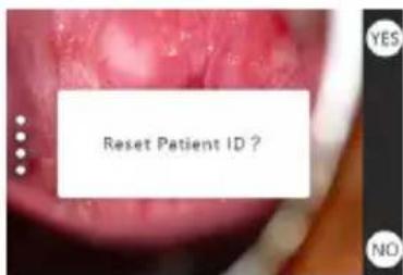 Reset Patient ID ? YES NO