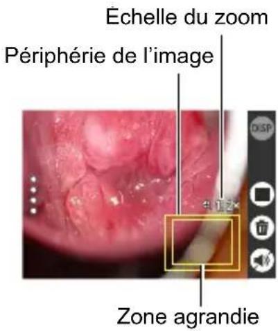 Échelle du zoom Périphérie de l'image Zone agrandie