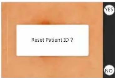 Reset Patient ID?