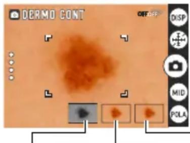 DERMO CONT OFF DISP MID POLA