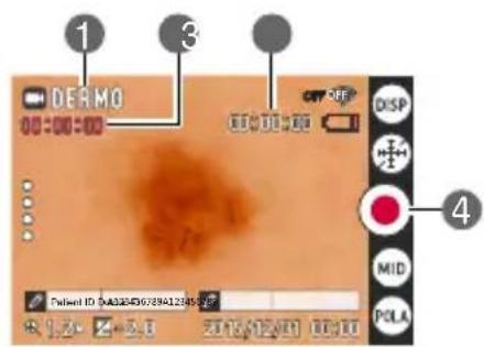 1 3 DERMO OFF DISP 4 Mid POLA Dated ID: D03204D6729412385 1.2+ 3.8 2015/12/01 00:00