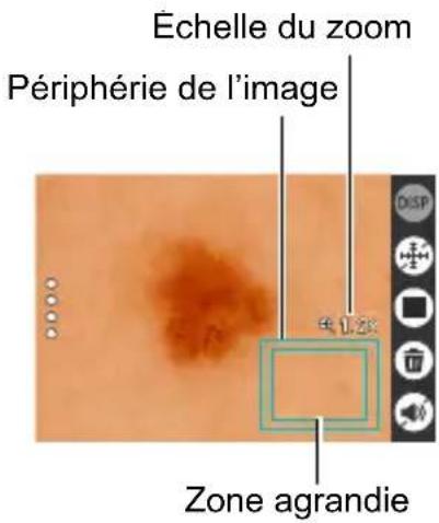 Échelle du zoom Périphérie de l'image Zone agrandie