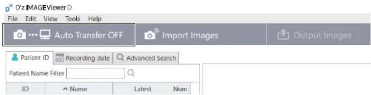 D'z IMAGEViewer D File Edit View Tools Help Auto Transfer OFF Import Images Output Images Patient ID Recording date Advanced Search Patient Name Filter ID ^ Name Latest Num.