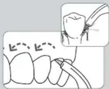 Waterpik WP-667 - По завершении использования устройства - 1