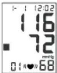 Sogo SS-14070W - UNREGELMÄSSIGE HERZSCHLAG-ERKENNUNG - 2