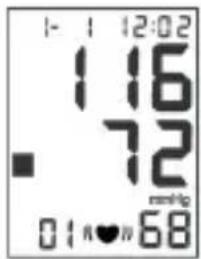 Sogo SS-14070W - DETECCIÓN DE LATIDO CARDÍACO IRREGULAR - 2