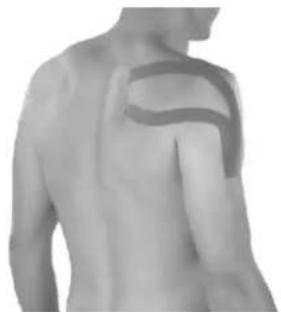 Newgen Medicals NC-2326 - Muscle deltoïde : bandage de l'épaule - 1