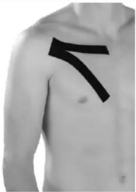 Newgen Medicals NC-2326 - Pectoralis major: Brustbereich tapen - 1