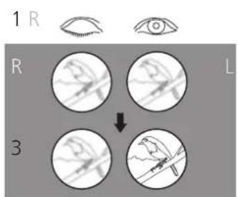 ZEISS Conquest HDX 10x56 - LEVERANSOMFATTNING - 20