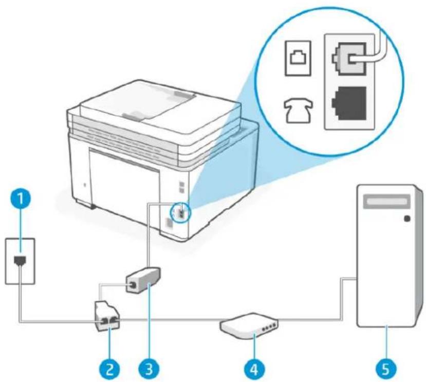 HP LaserJet Pro MFP M3102fdn - Configurer l'imprimante avec un modem d'ordinateur DSL/ADSL - 1