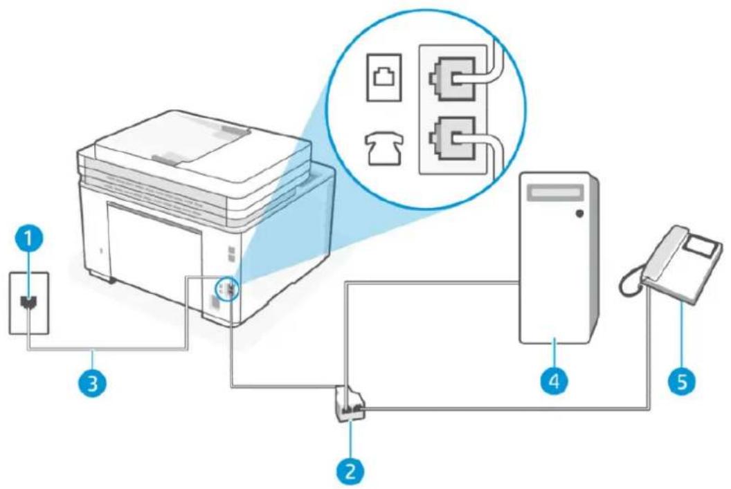 HP LaserJet Pro MFP M3102fdn - Ligne vocale/télécopie partagée avec un modem bas débit d'ordinateur - 3
