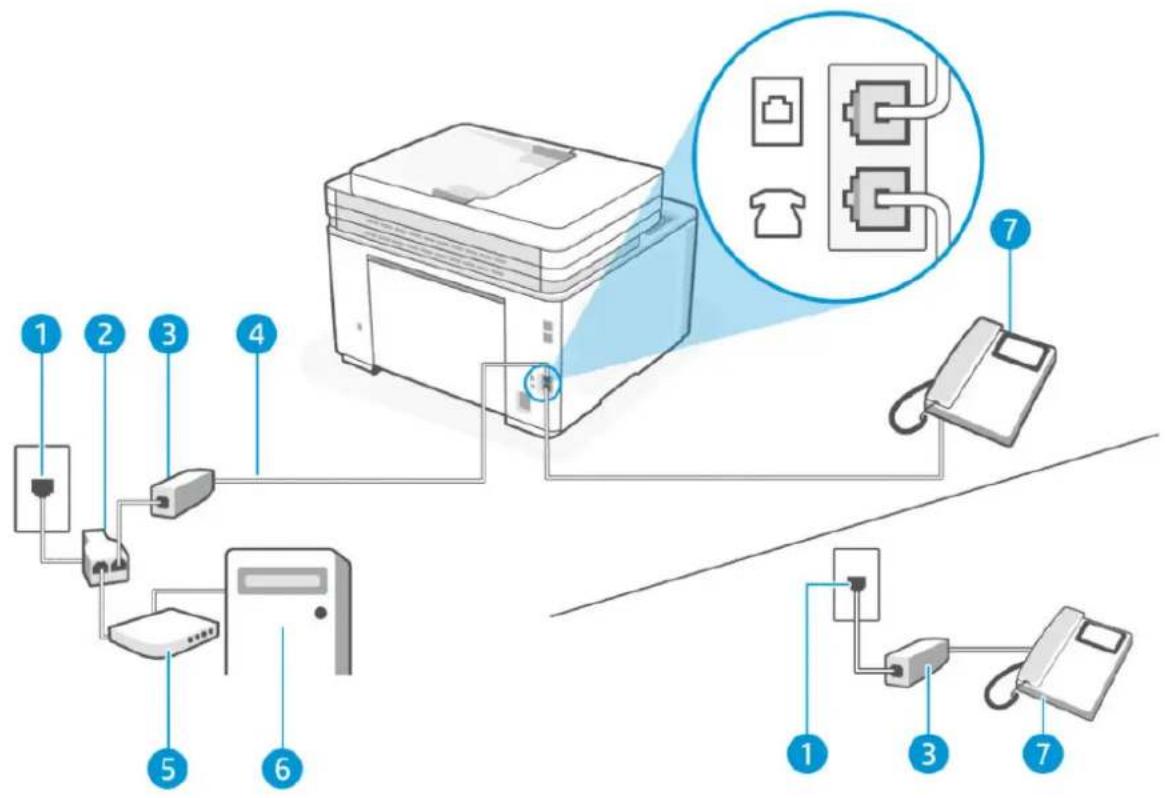 HP LaserJet Pro MFP M3102fdn - Ligne vocale/télécopie partagée avec un modem bas débit d'ordinateur - 5