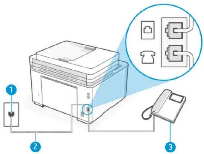 HP LaserJet Pro MFP M3102fdn - Cas E : Ligne vocale et de télécopie partagée - 1