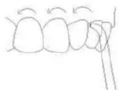 Sogo SS-12360 - Periodontitis-Aufsatz: - 2