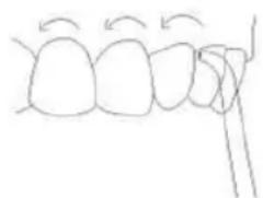 Sogo SS-12360 - Boquilla periodontal: - 2