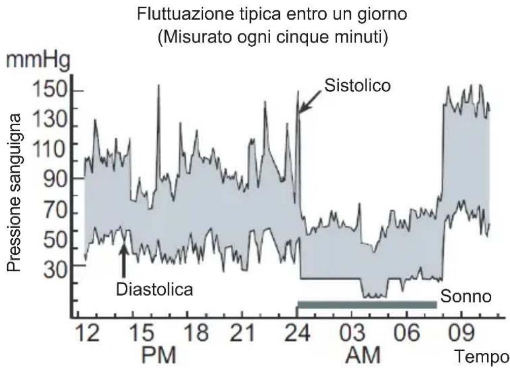 Sogo SS-14075W - Variazioni della pressione sanguigna - 1
